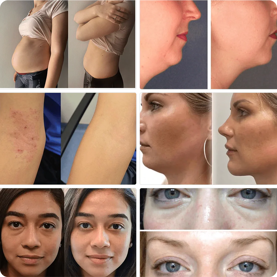 2. It Targets All Types Of Facial Bloat