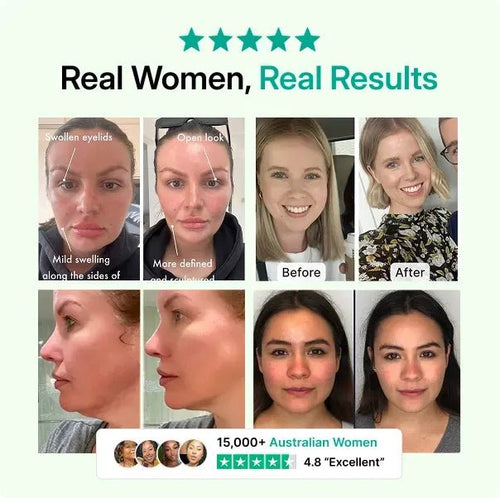 Golden Root Lymphatic Drainage Cleanse 2025